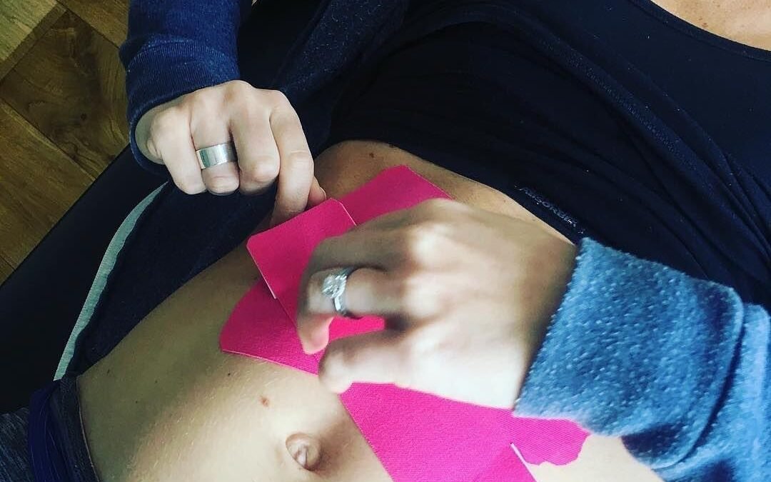 Help with diastasis 10 years postnatal